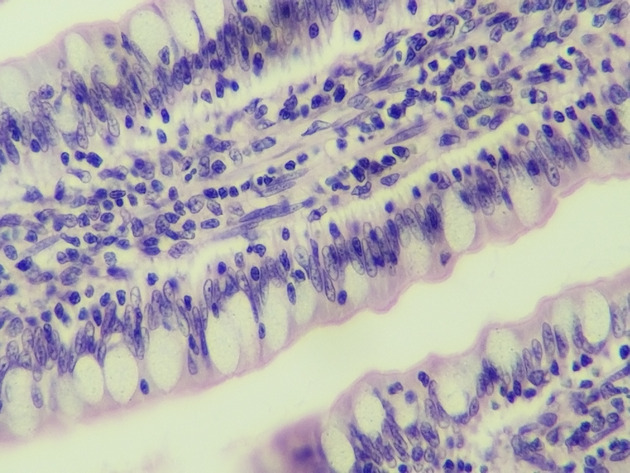 Simple Columnar Epithelium Slides - Simple Columnar Epithelium 05 400X